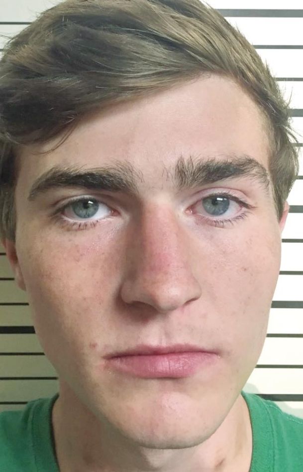 Starkville Teen Arrested For Alleged Attack On Officer The Dispatch