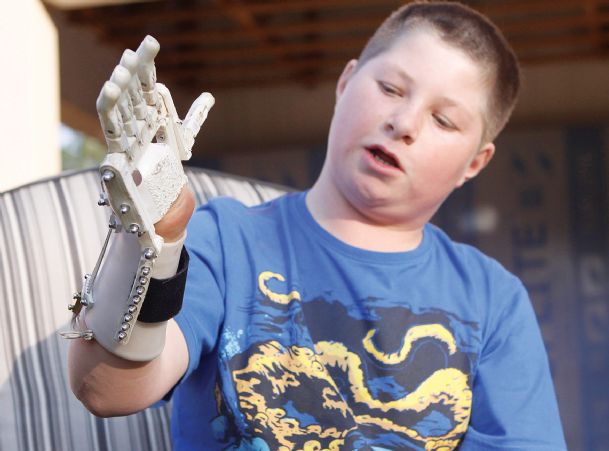 Robohand uses 3-D printing to replace lost digits